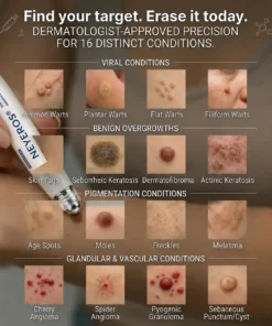 NEYEROS®✨ 𝟕-𝐃𝒂𝘆 𝐒𝗸𝐢𝐧 𝐓𝒂𝗴 & 𝐒𝐩𝙤𝐭 𝐄𝐫𝒂𝐬𝙚𝐫 𝐏𝐚𝐢𝐧𝐥𝐞𝐬𝐬 & 𝐒𝐜𝐚𝐫-𝐅𝐫𝐞𝐞 𝐀𝐝𝐯𝐚𝐧𝐜𝐞𝐝 𝐈𝐦𝐩𝐞𝐫𝐟𝐞𝐜𝐭𝐢𝐨𝐧 𝐑𝐞𝐦𝐨𝐯𝐚𝐥 𝐑𝐨𝐥𝐥𝐞𝐫𝐛𝐚𝐥𝐥 𝐏𝐞𝐧