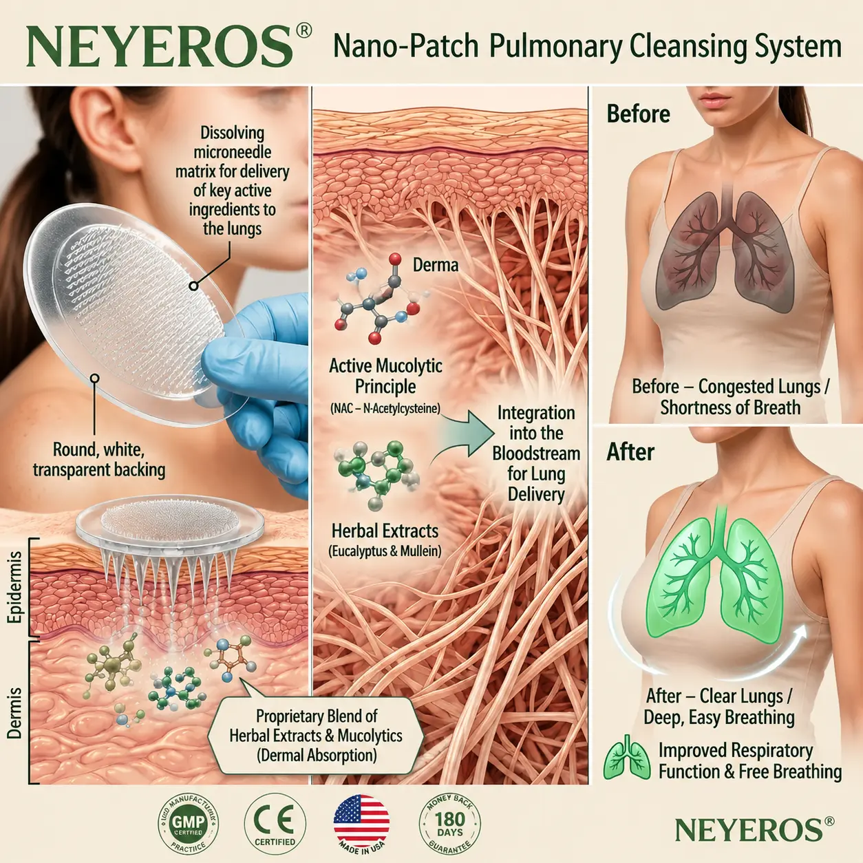 NEYEROS® 𝑵𝑨𝑵𝑶 𝑴𝑰𝑪𝑹𝑶-𝑵𝑬𝑬𝑫𝑳𝑬𝑷𝑨𝑻𝑪𝑯