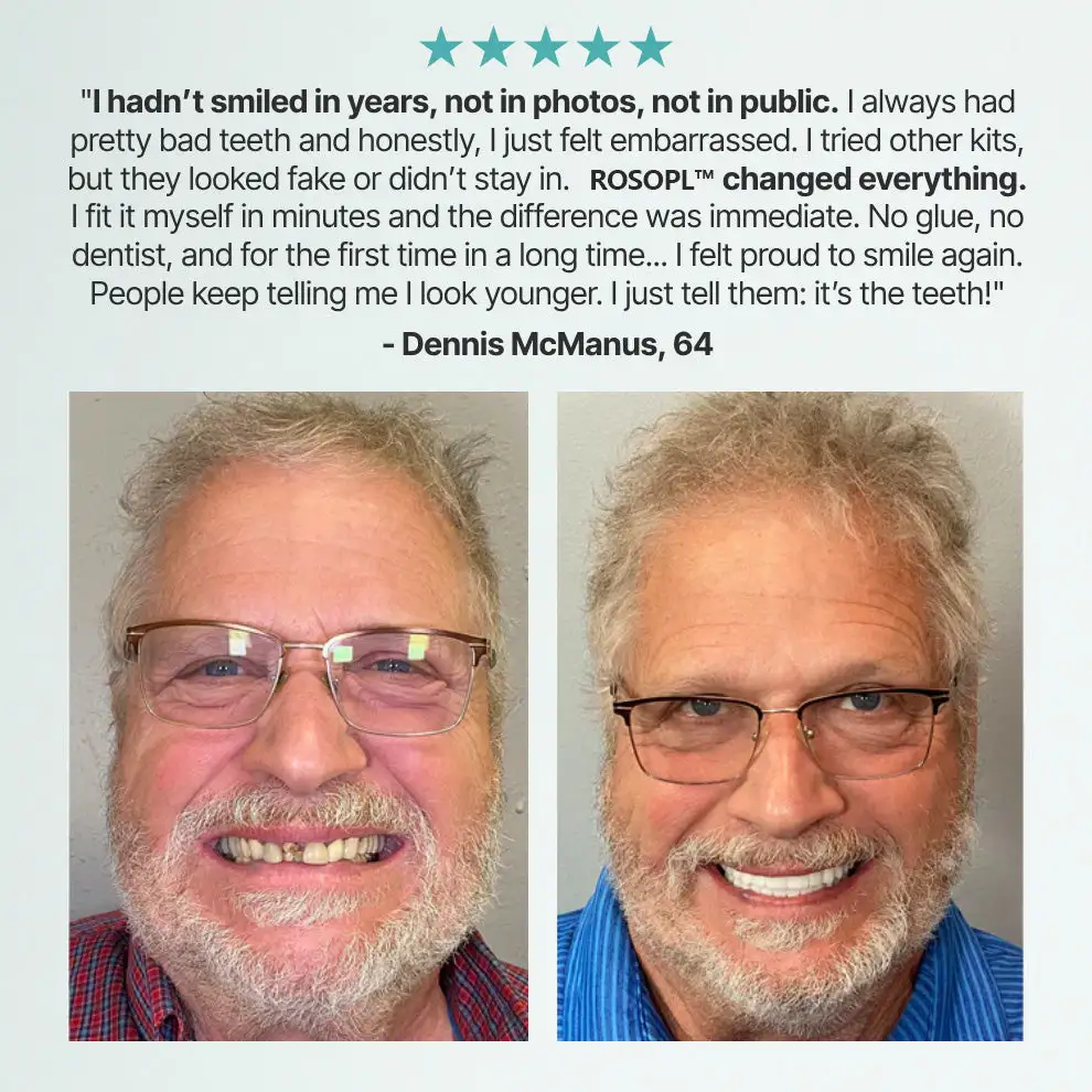 NEYEROS® Advanced FunctionalDentures - Get Your Smile BackWith A Secure & Comfortable Fit