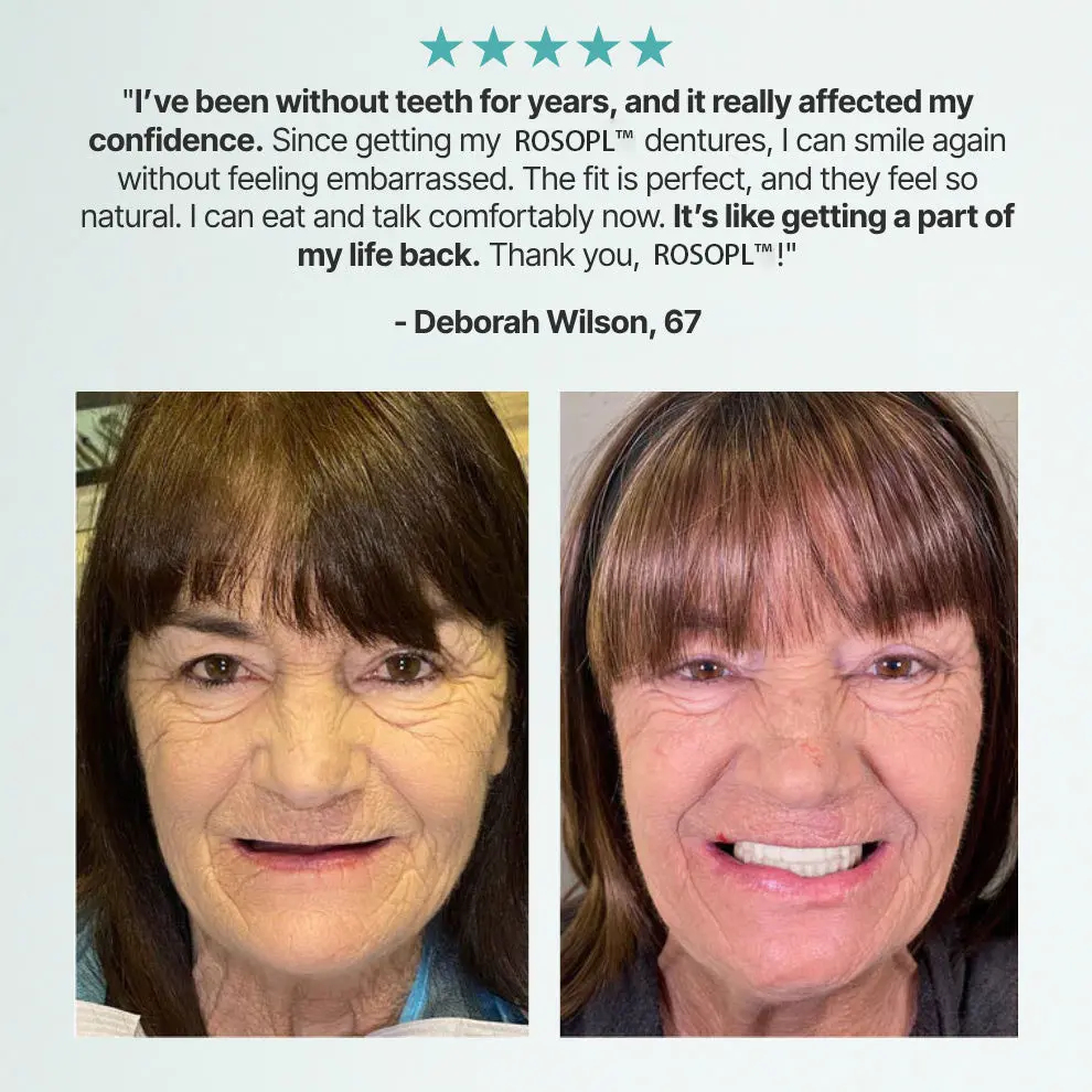 NEYEROS® Advanced FunctionalDentures - Get Your Smile BackWith A Secure & Comfortable Fit
