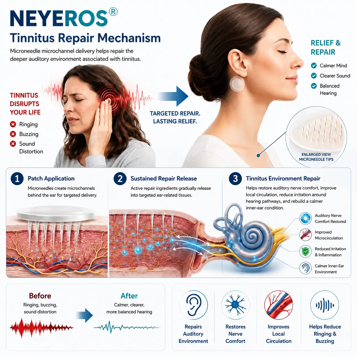 NEYEROS® HEARING REPAIR MICRONEEDLE PATCHES