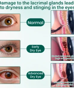 NEYEROS® OptiClear Nano Eye Roller Serum