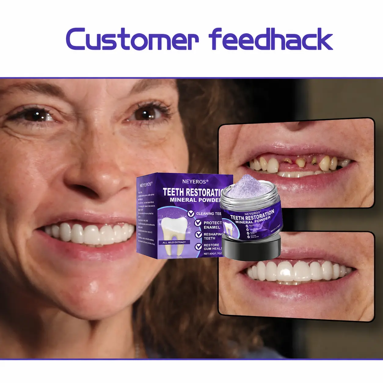 NEYEROS® Tooth Repair Mineral Powder