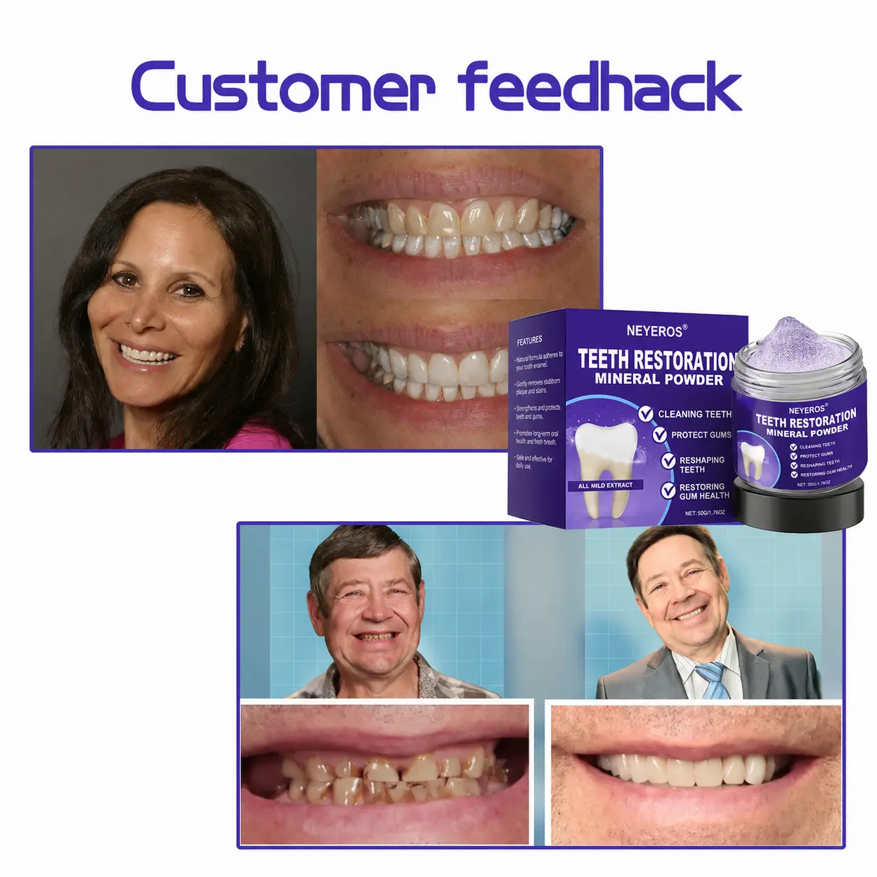 NEYEROS® Tooth Repair Mineral Powder
