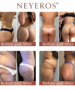 Neyeros® CurveSculpt Micro-Patch