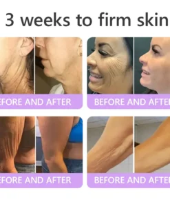 𝑵𝒆𝒚𝒆𝒓𝒐𝒔® PDRN Multi-Peptide Massaging Body Roller Cream