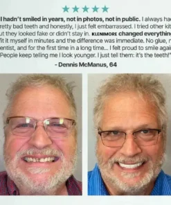 NEYEROS® Adaptive Denture System